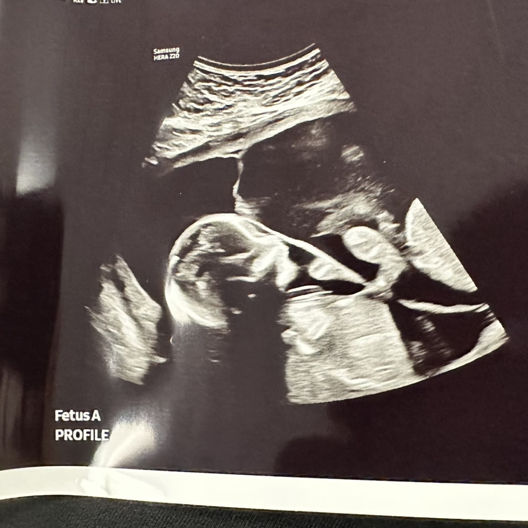 Photo shared by Rachel for their Babylist baby registry.