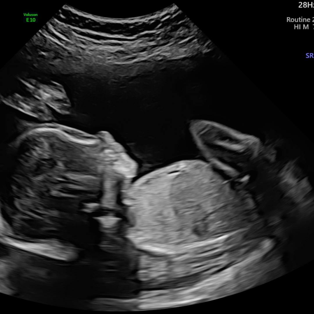 Photo shared by Abby for their Babylist baby registry.