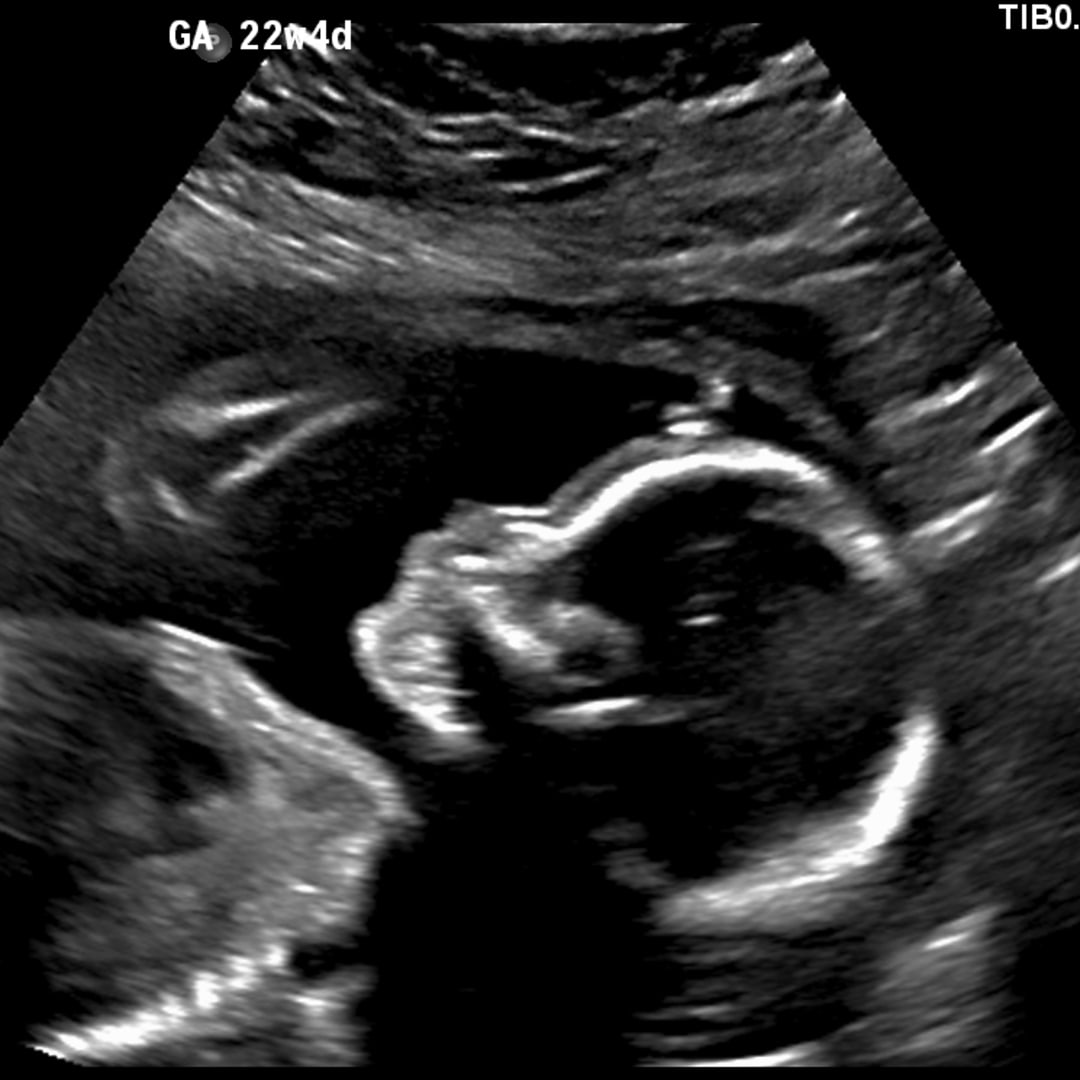 Photo shared by Erin for their Babylist baby registry.