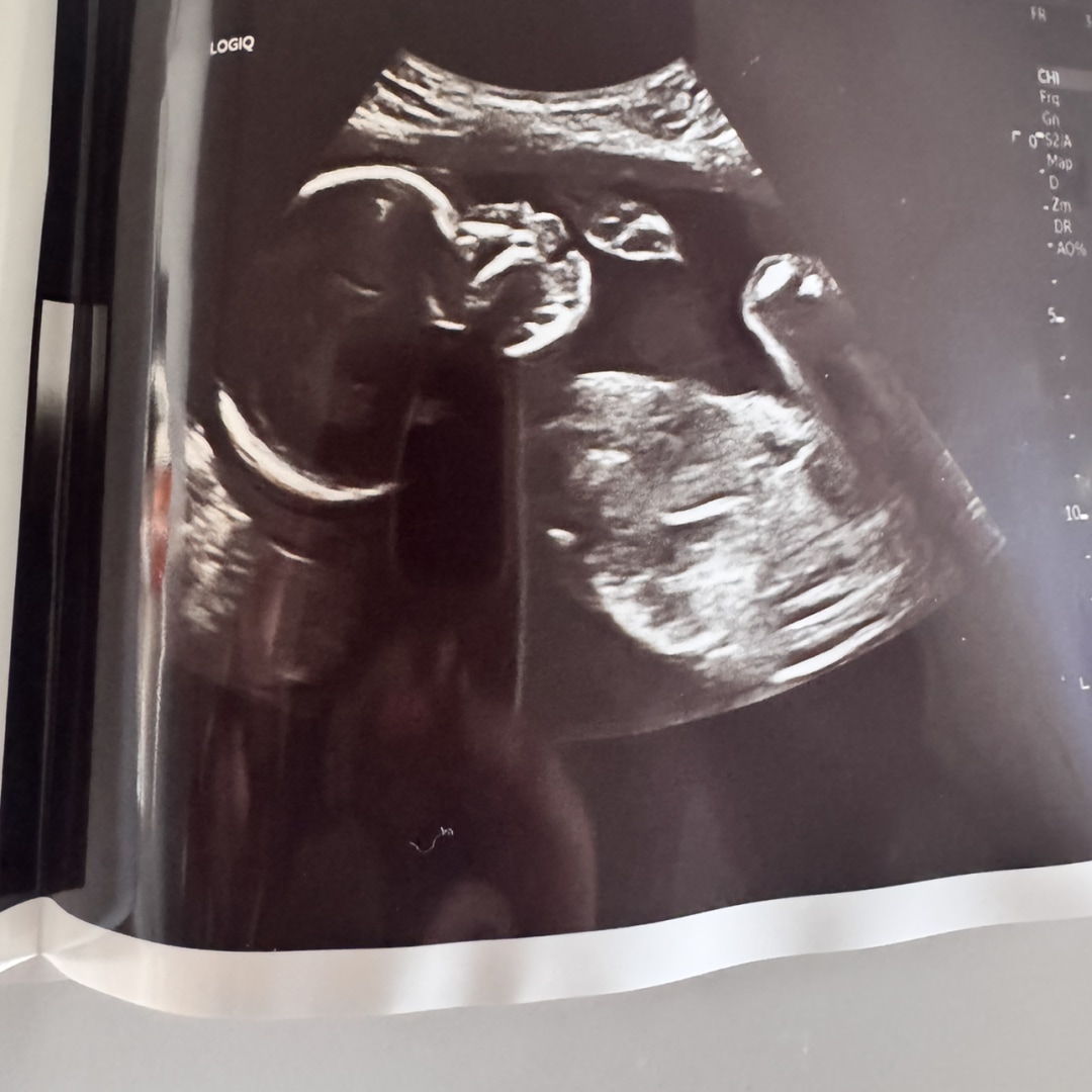 Photo shared by Cassie for their Babylist baby registry.