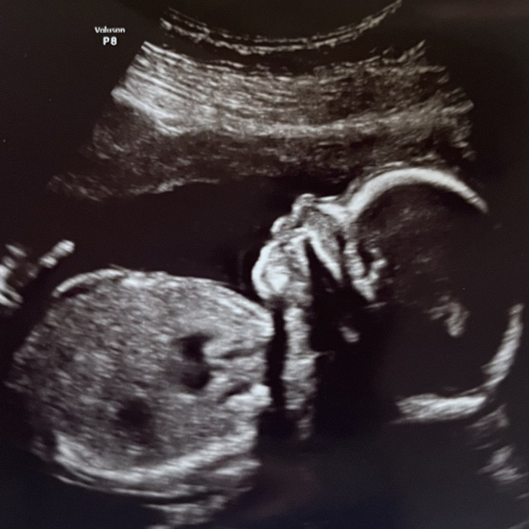 Photo shared by Allie for their Babylist baby registry.