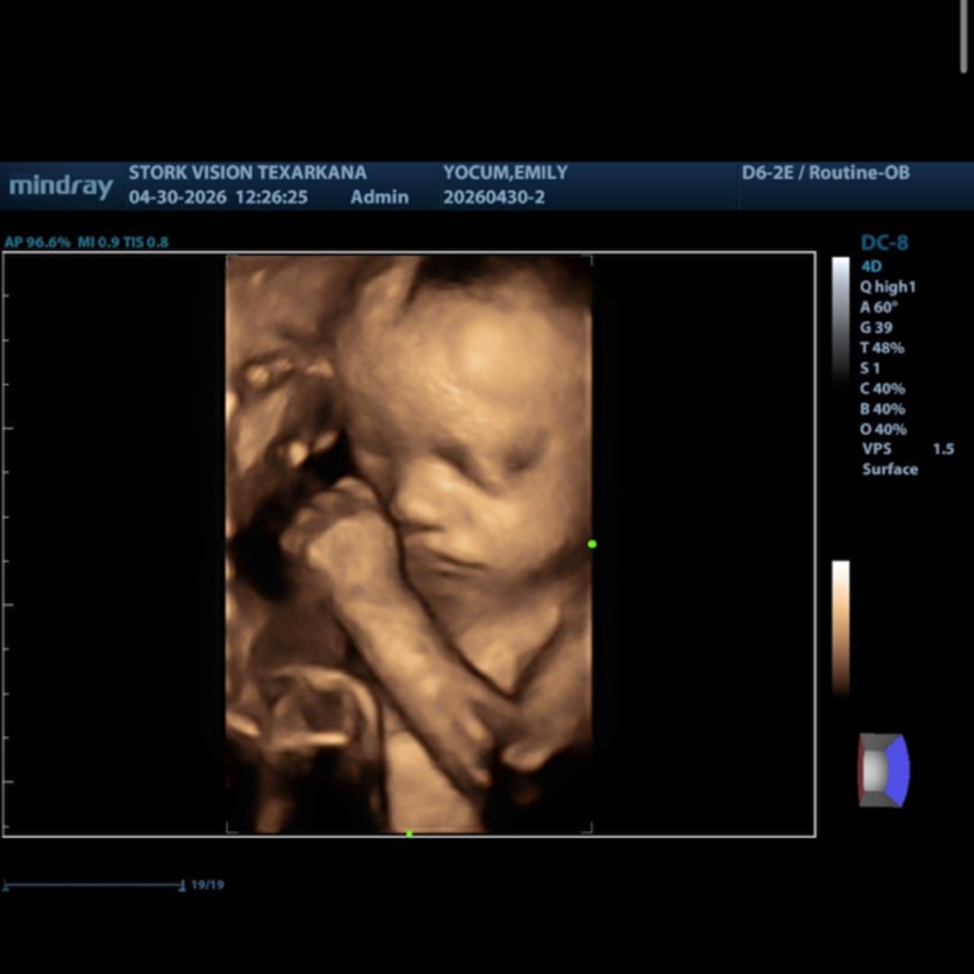Photo shared by Emily for their Babylist baby registry.