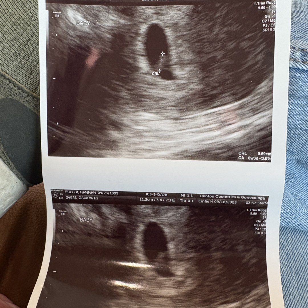 Photo shared by Hannah for their Babylist baby registry.