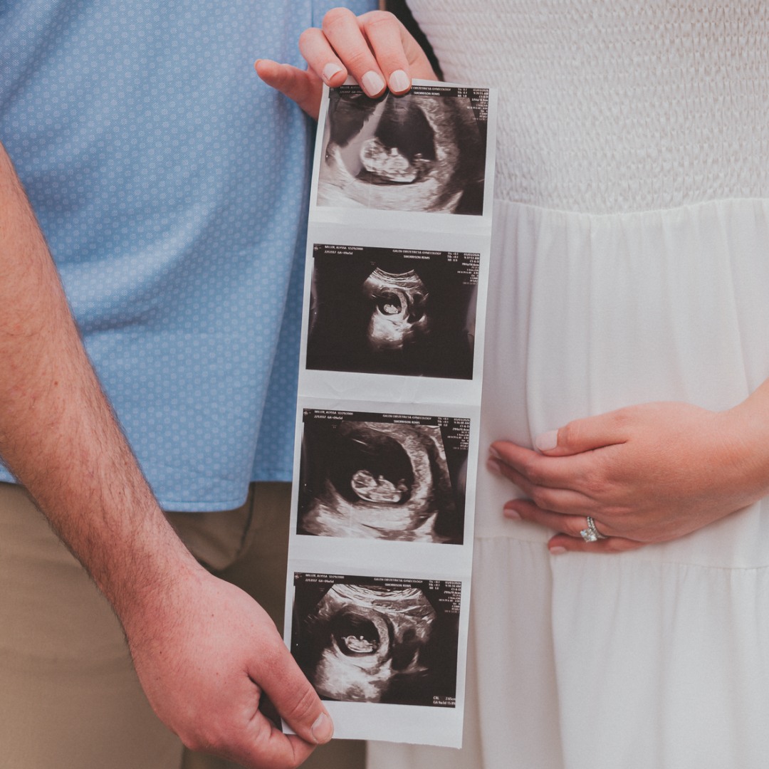 Photo shared by Alyssa for their Babylist baby registry.