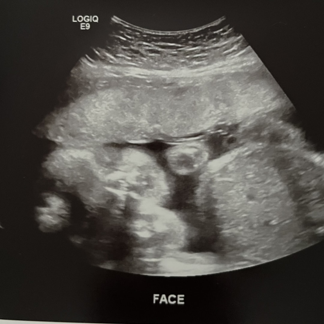 Photo shared by Rachael for their Babylist baby registry.