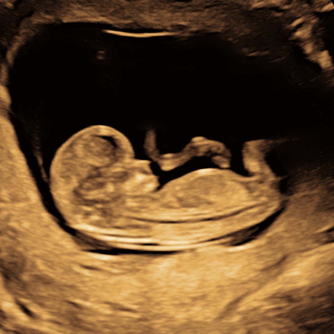 Photo shared by Jenna for their Babylist baby registry.