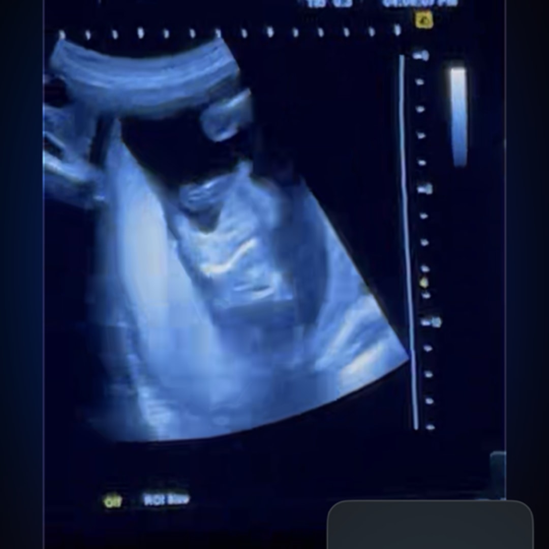 Photo shared by Alaiyah for their Babylist baby registry.