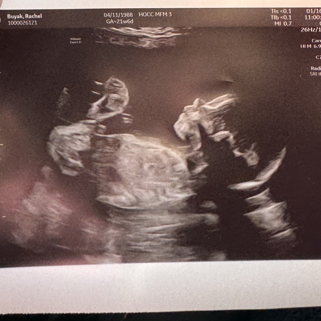 Photo shared by Rachel for their Babylist baby registry.