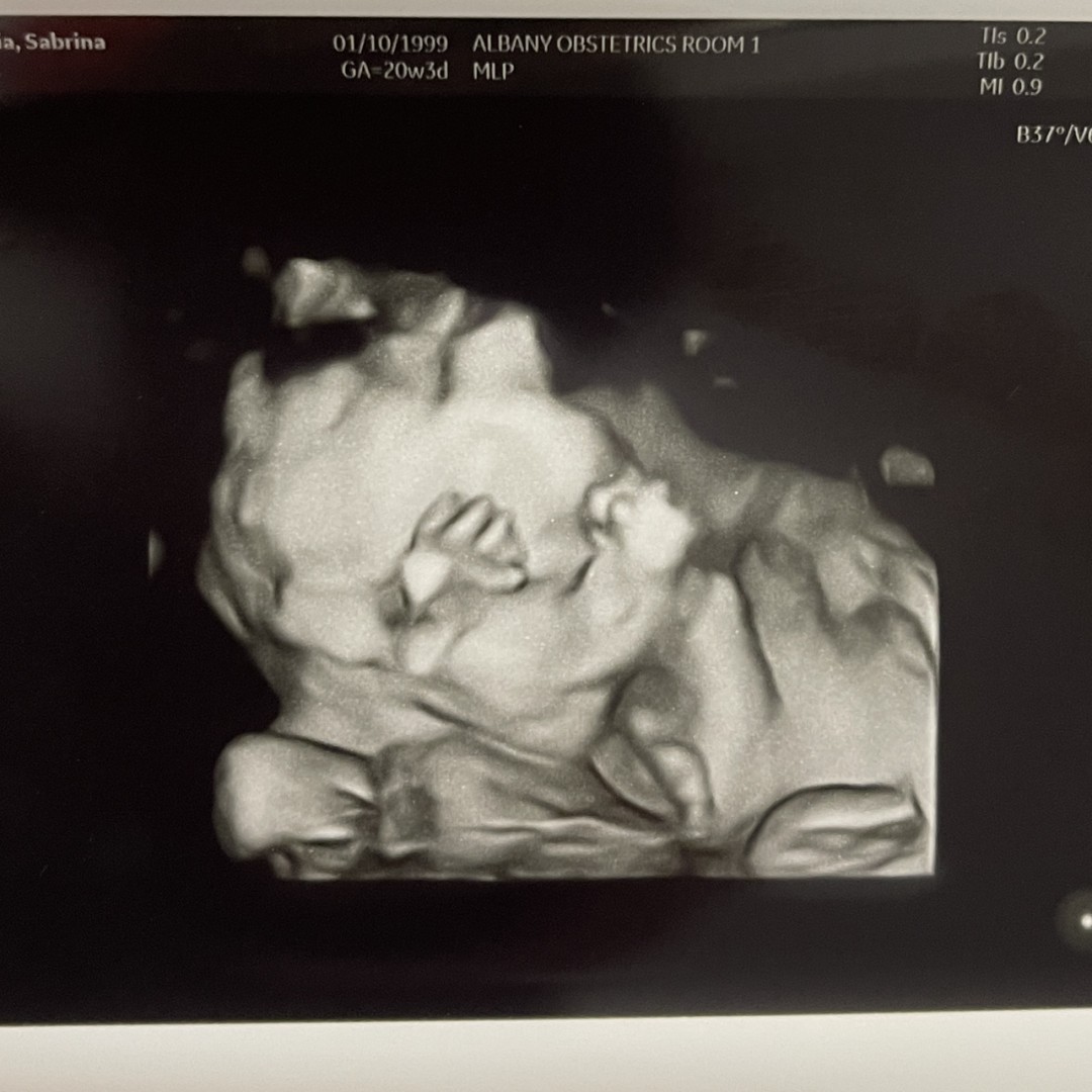 Photo shared by Sabrina for their Babylist baby registry.