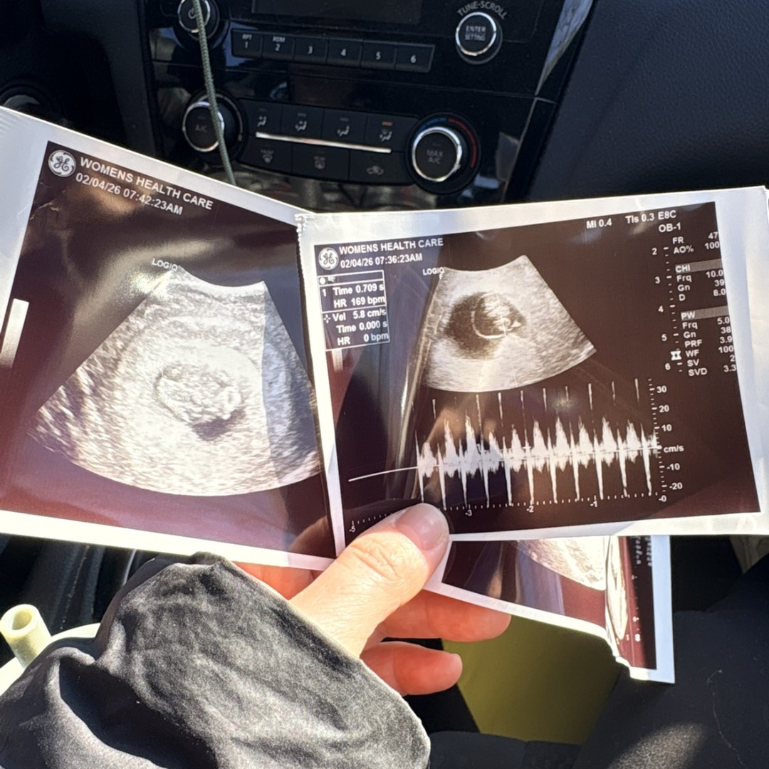 Photo shared by Alison for their Babylist baby registry.