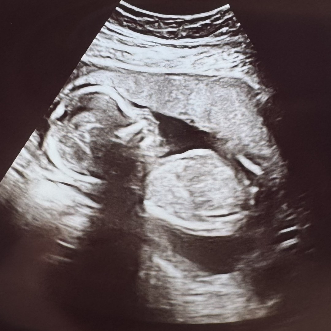 Photo shared by Jylene for their Babylist baby registry.