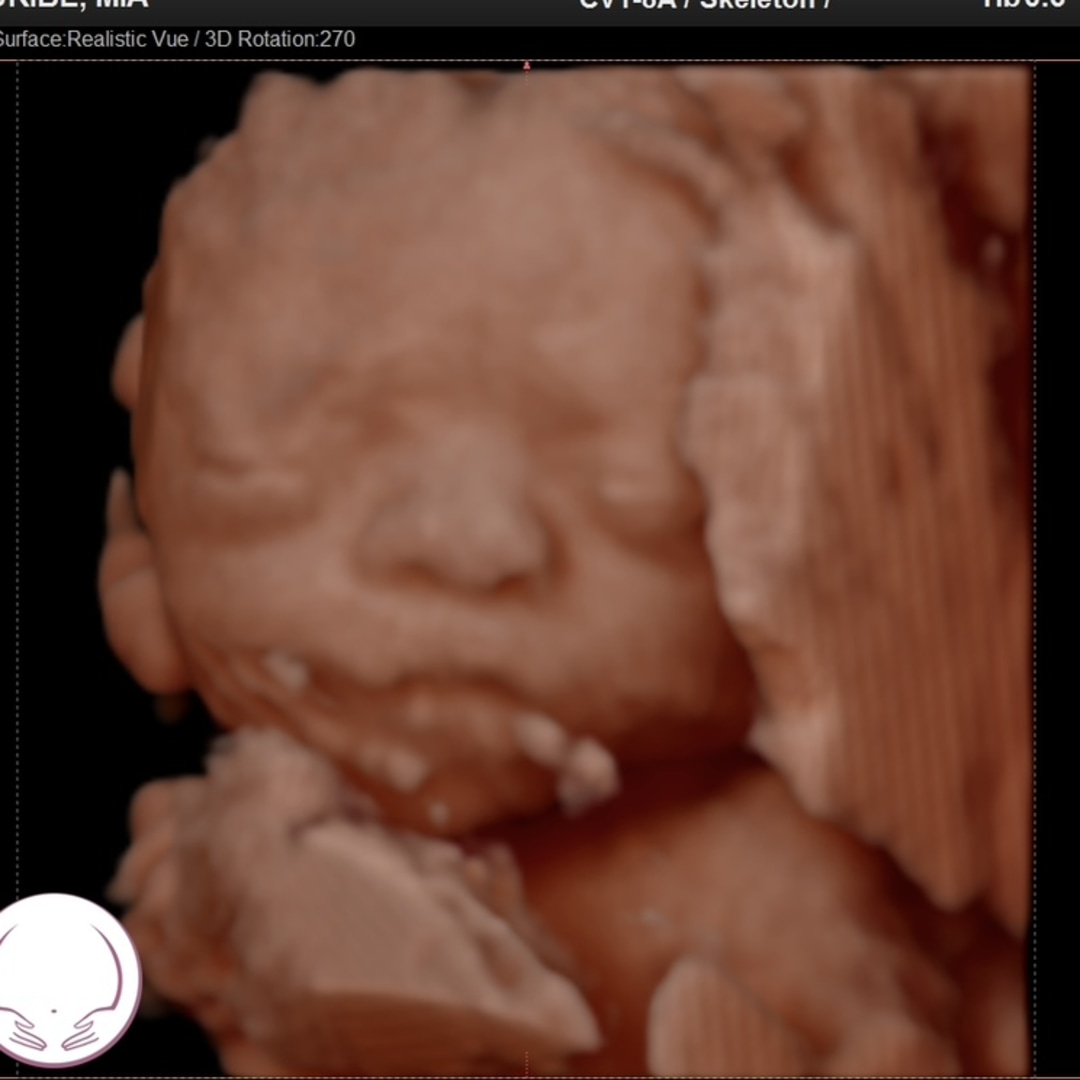 Photo shared by Mia for their Babylist baby registry.