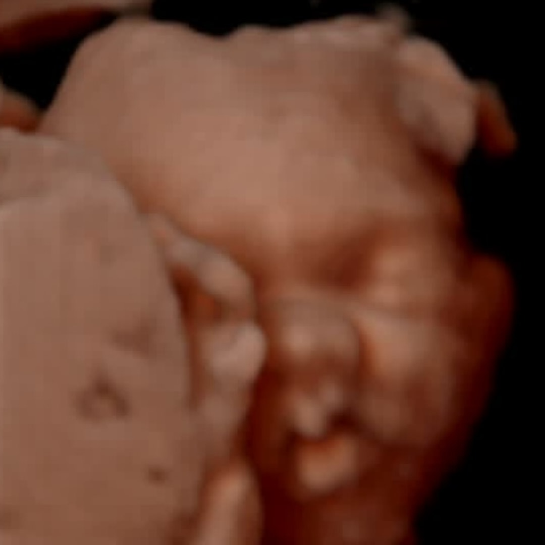 Photo shared by Brooklyn for their Babylist baby registry.