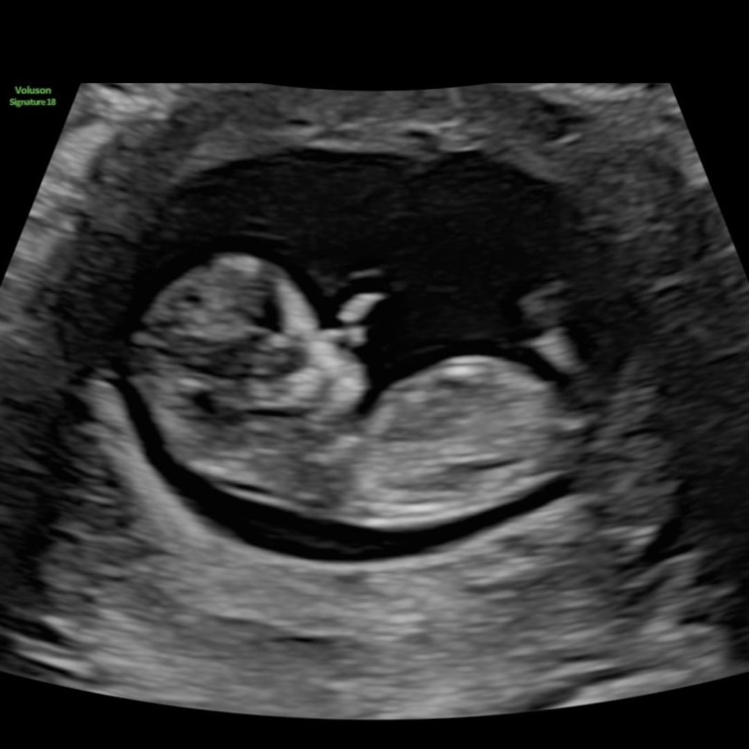 Photo shared by Anne for their Babylist baby registry.