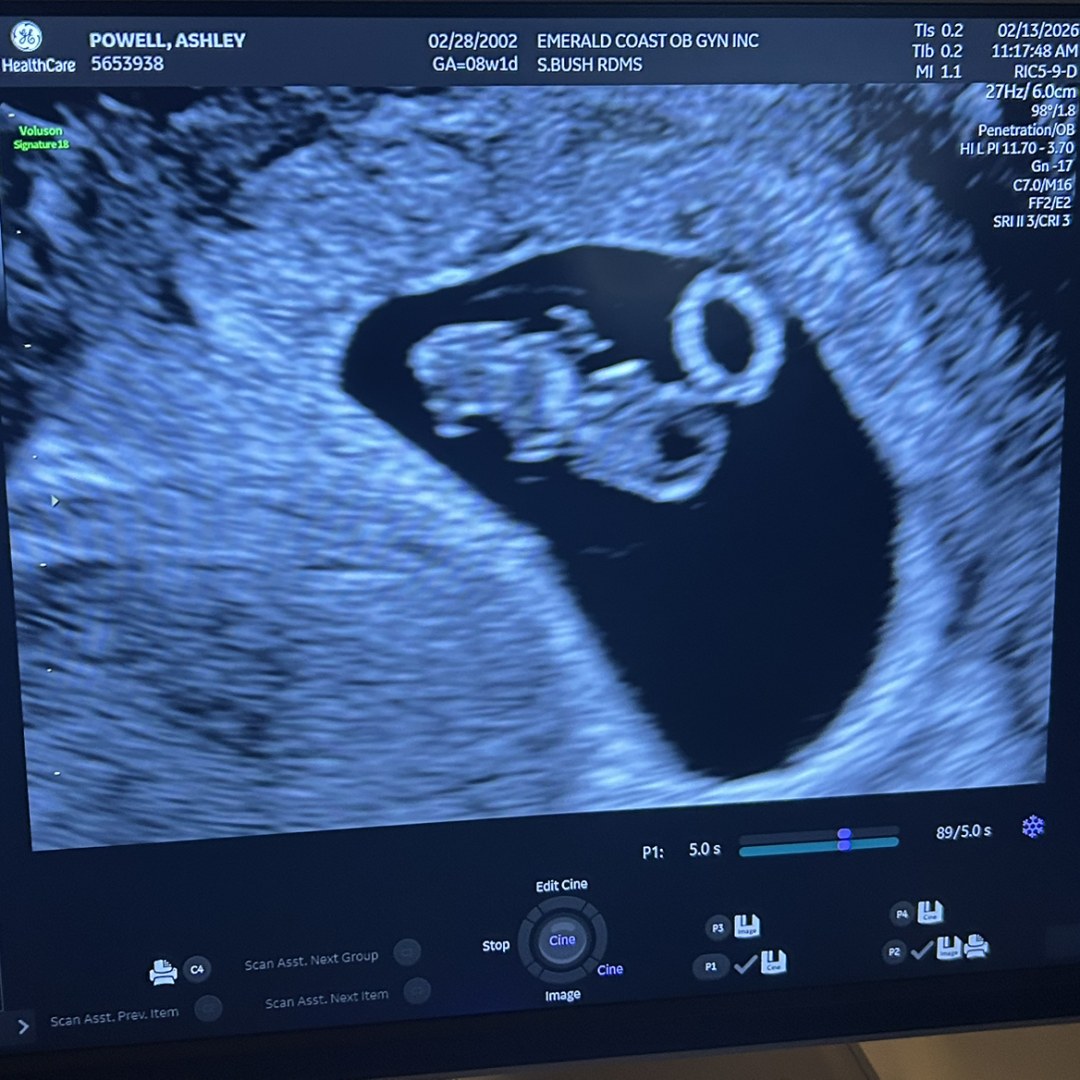 Photo shared by Ashley for their Babylist baby registry.
