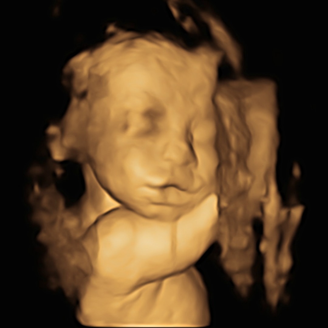 Photo shared by Cassidy for their Babylist baby registry.