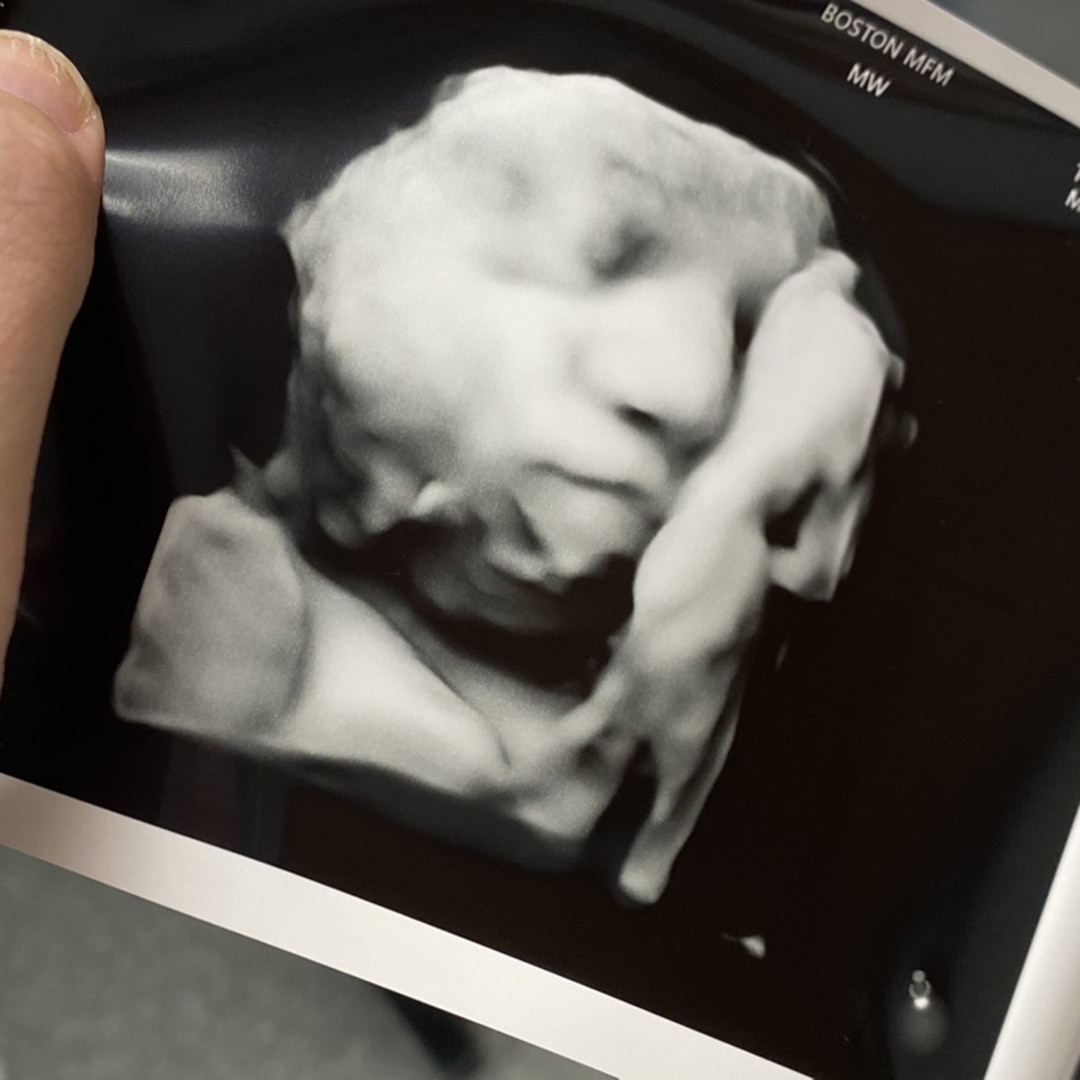 Photo shared by Alana for their Babylist baby registry.