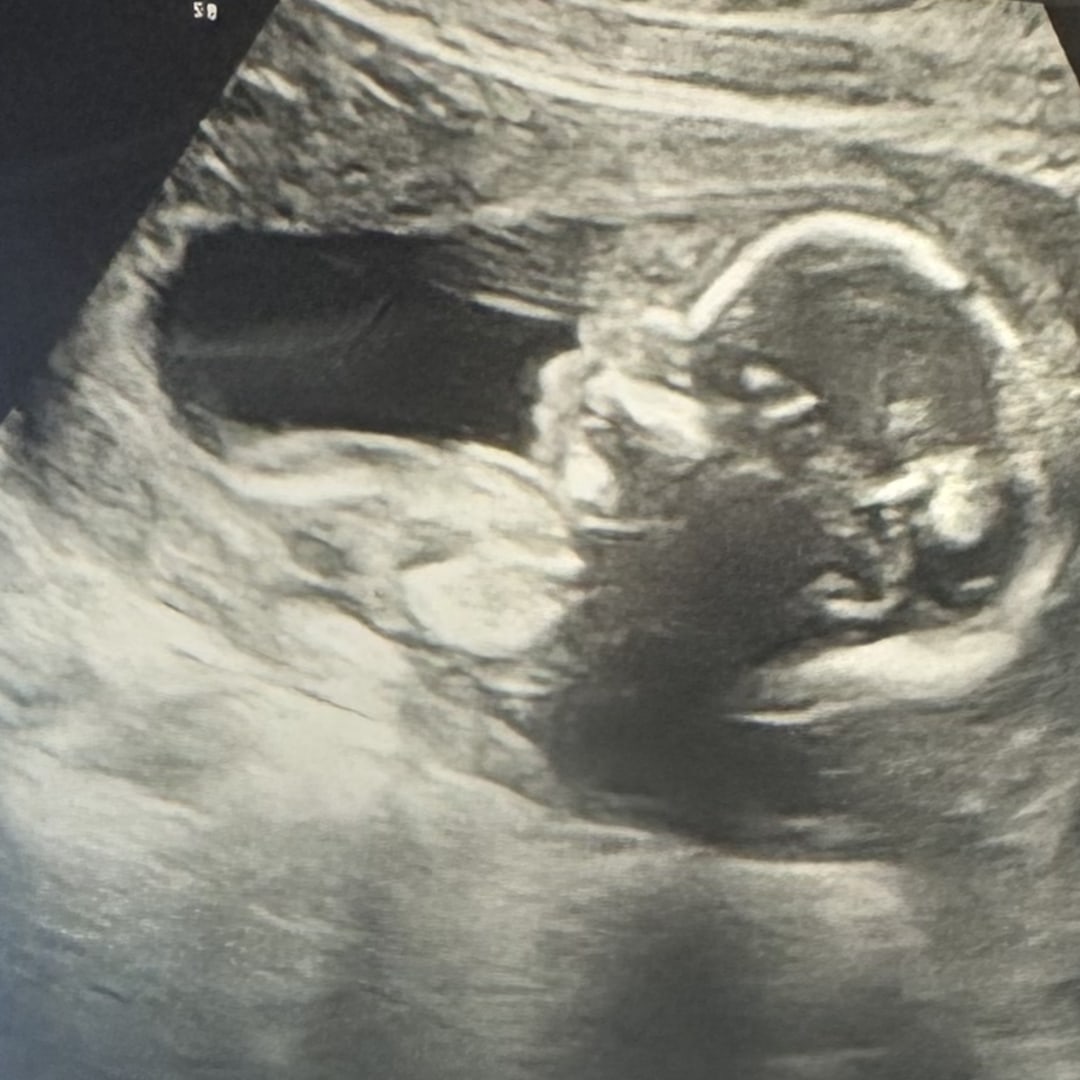 Photo shared by Alisha for their Babylist baby registry.
