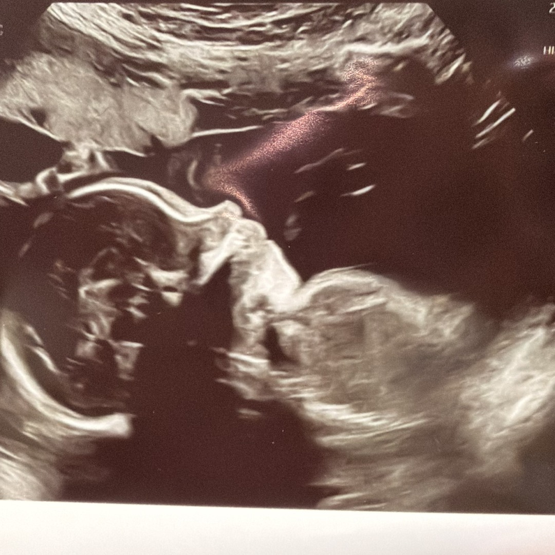 Photo shared by Danielle for their Babylist baby registry.