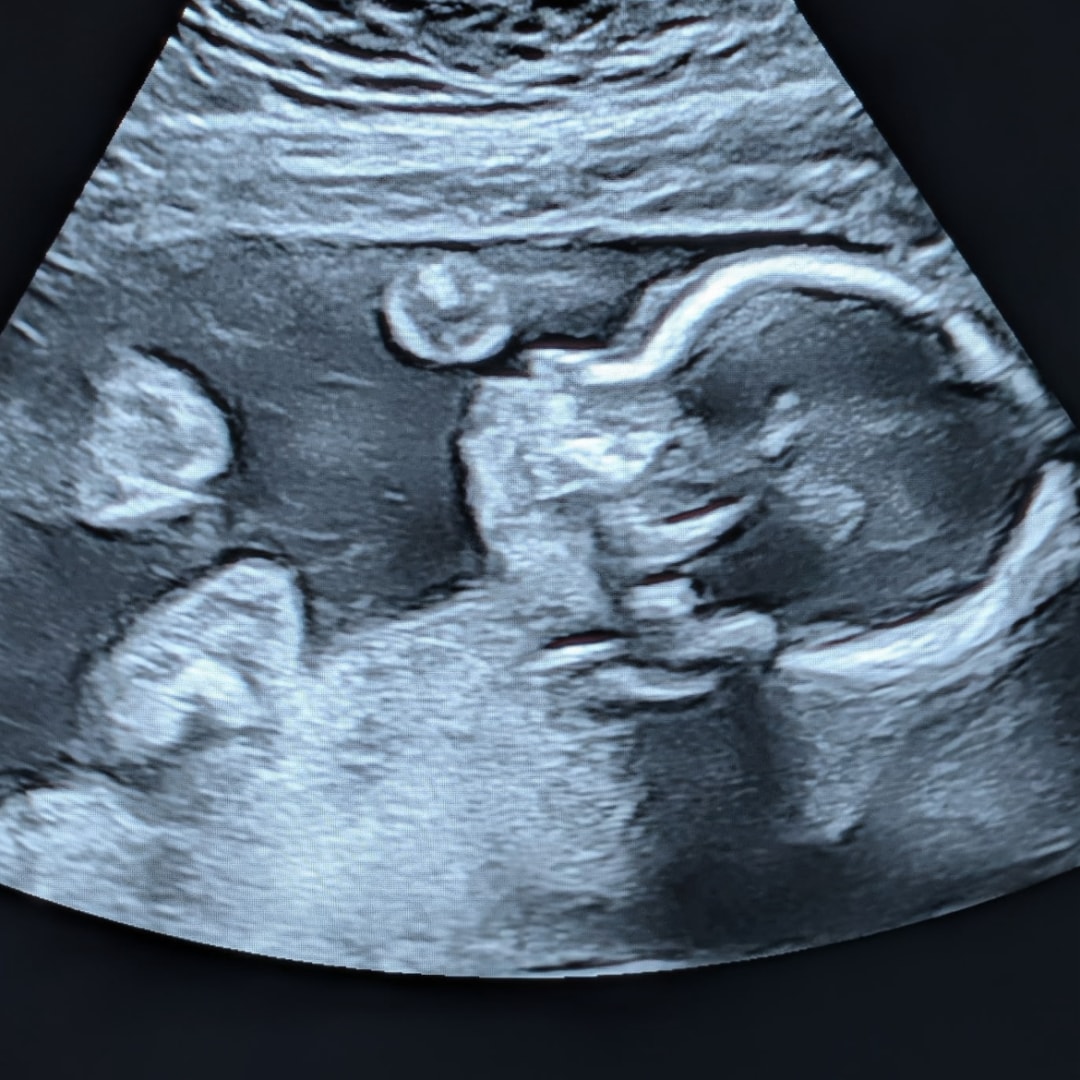 Photo shared by Alexis for their Babylist baby registry.