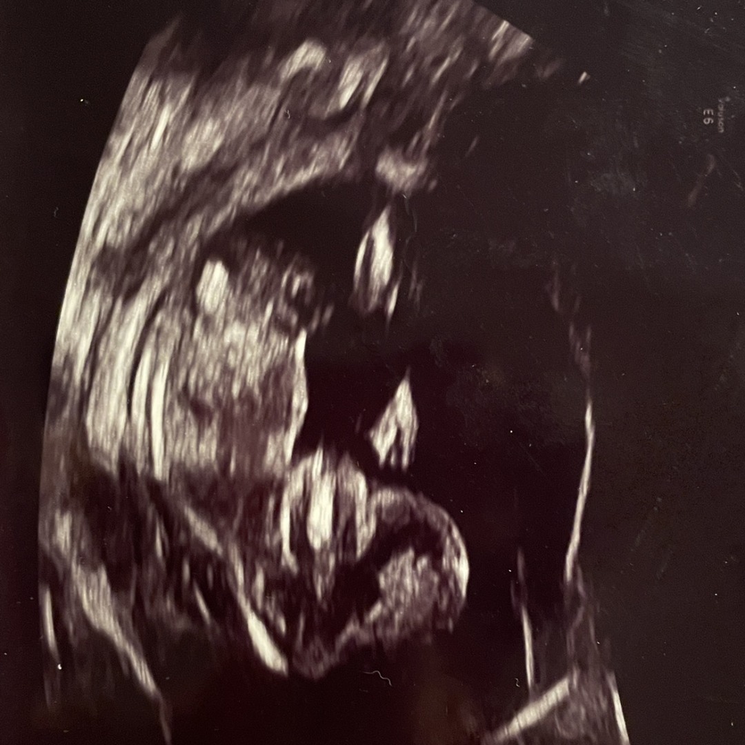 Photo shared by Erin for their Babylist baby registry.