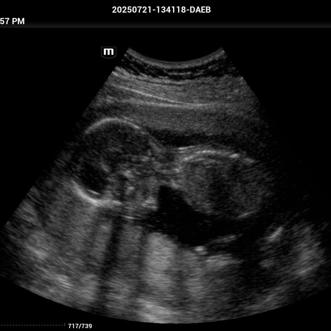 Photo shared by Lauren for their Babylist baby registry.