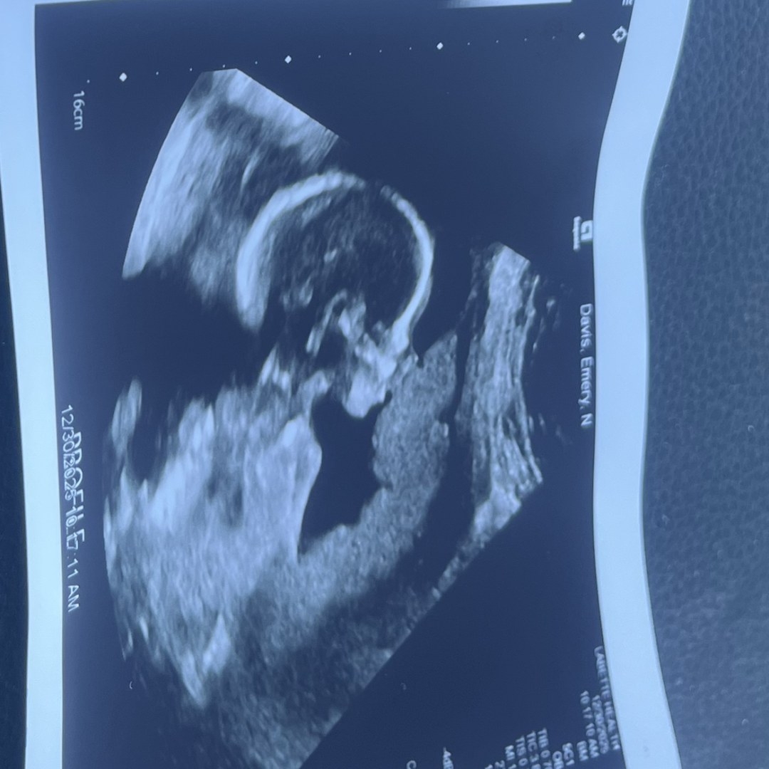 Photo shared by Emery for their Babylist baby registry.