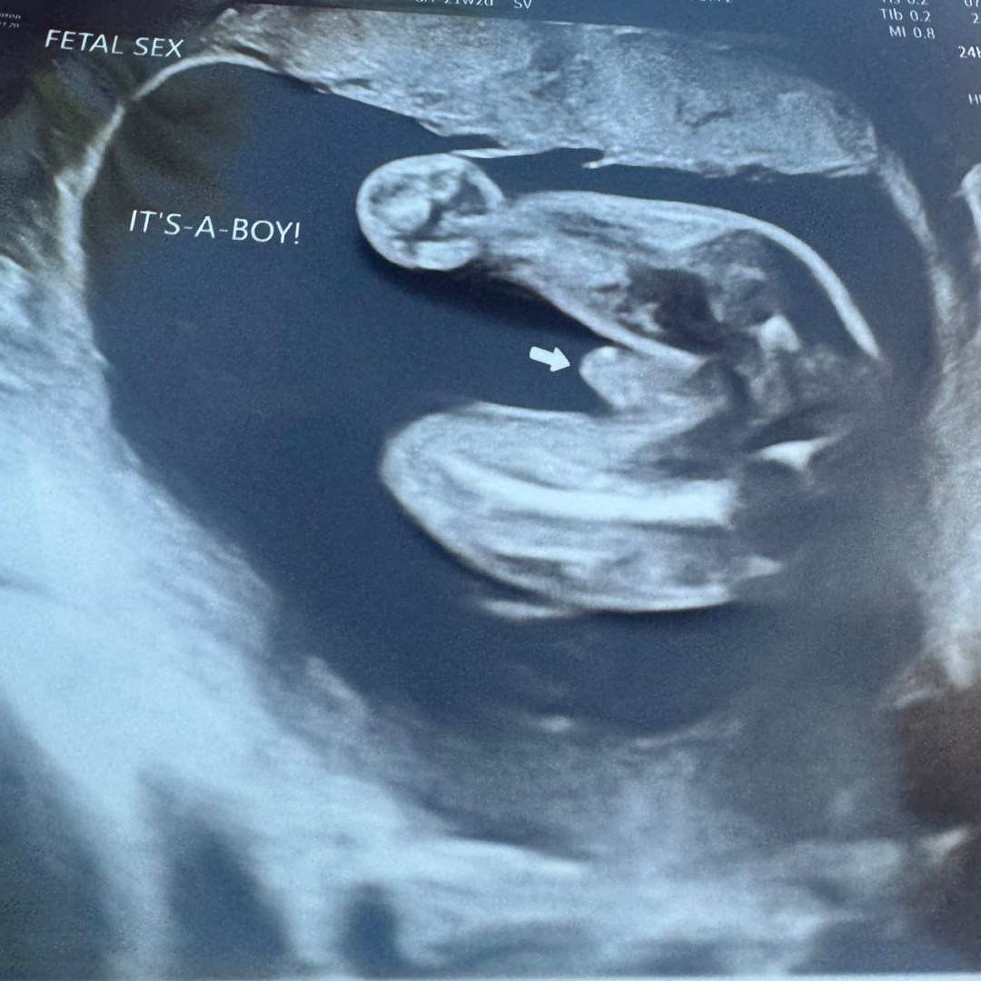 Photo shared by Alex for their Babylist baby registry.