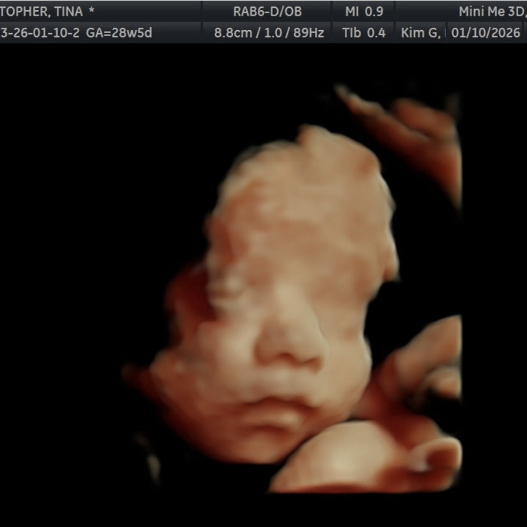 Photo shared by Tina for their Babylist baby registry.