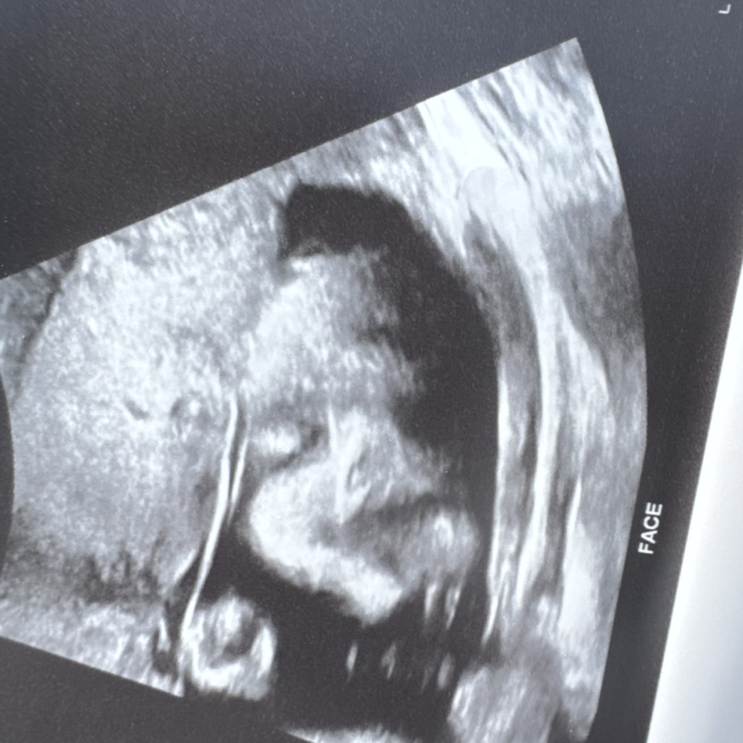 Photo shared by Diana for their Babylist baby registry.
