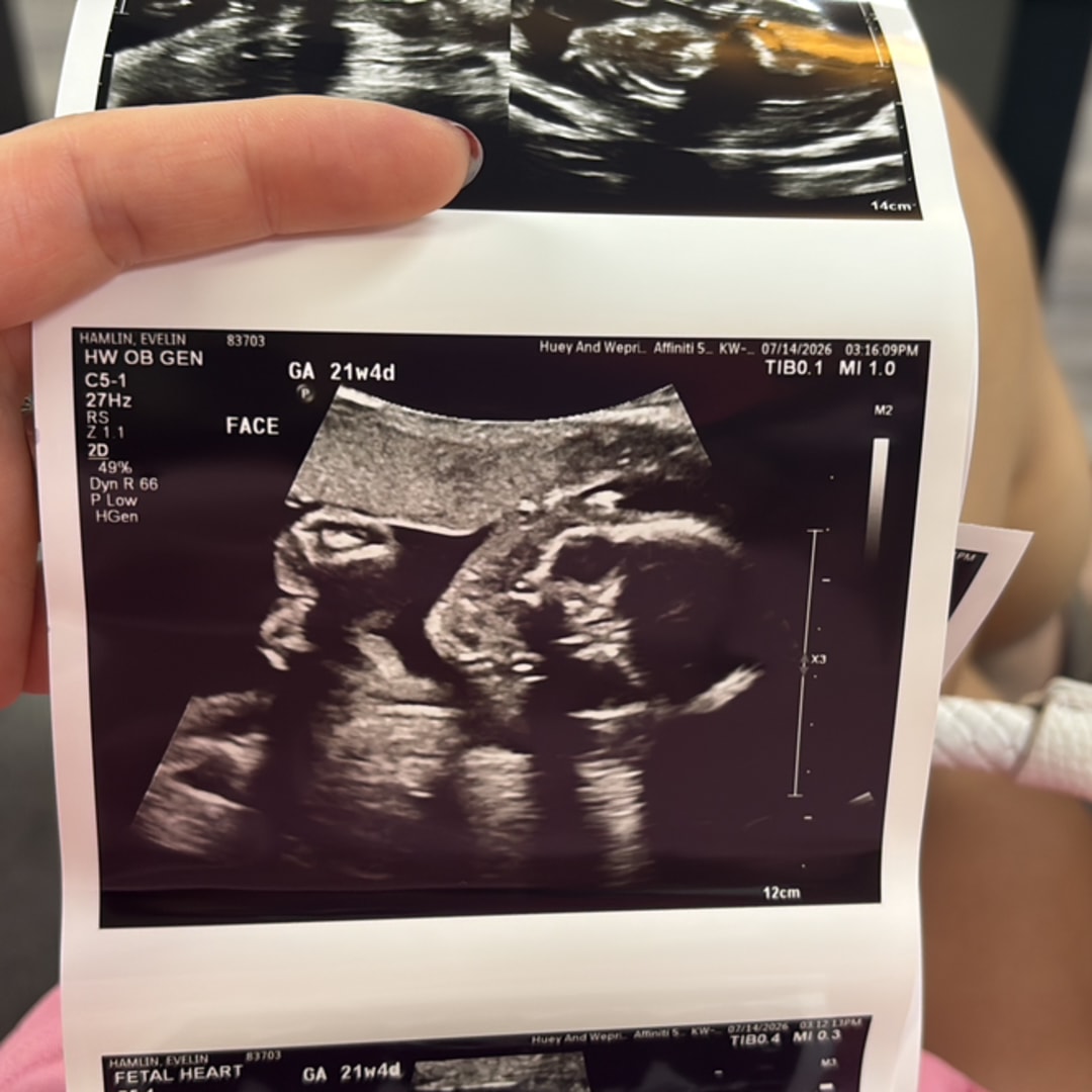 Photo shared by Tristan for their Babylist baby registry.