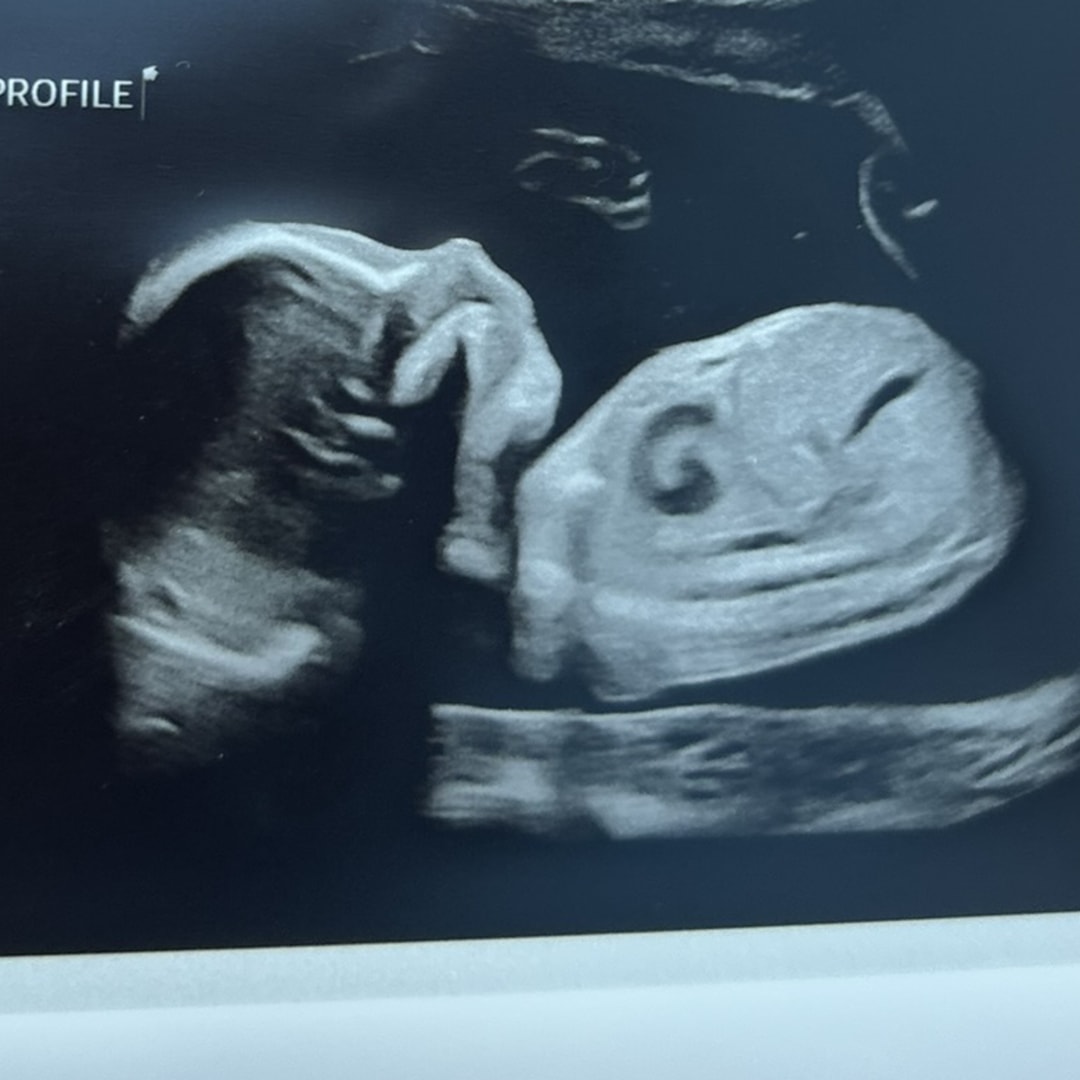 Photo shared by Kaycee for their Babylist baby registry.