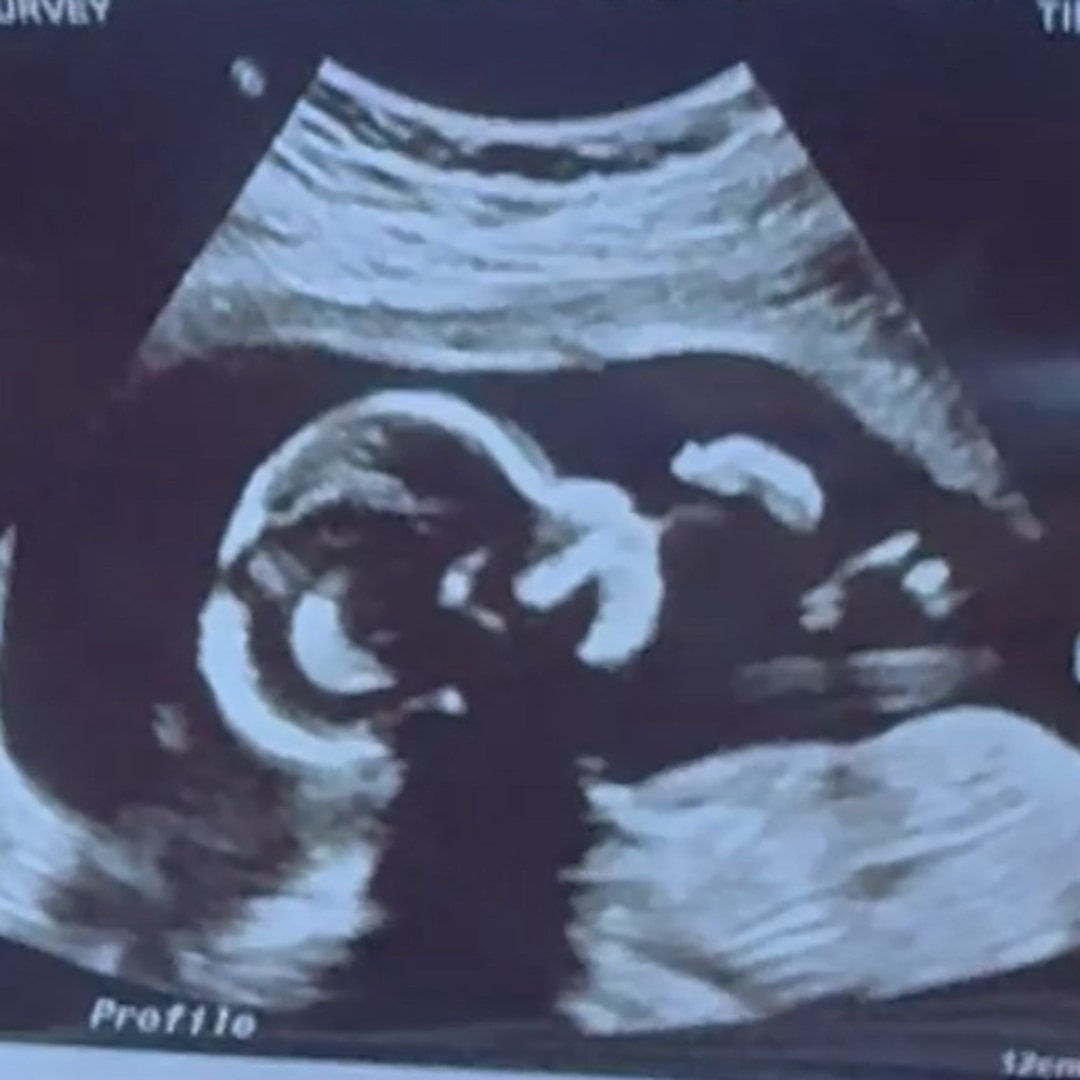 Photo shared by Gurleen for their Babylist baby registry.