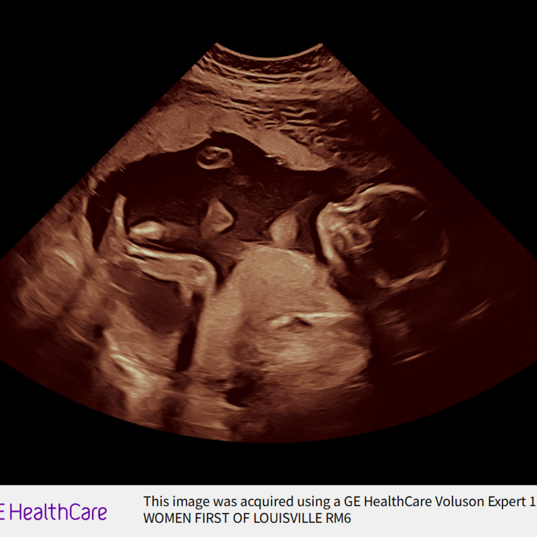 Photo shared by Hanna for their Babylist baby registry.
