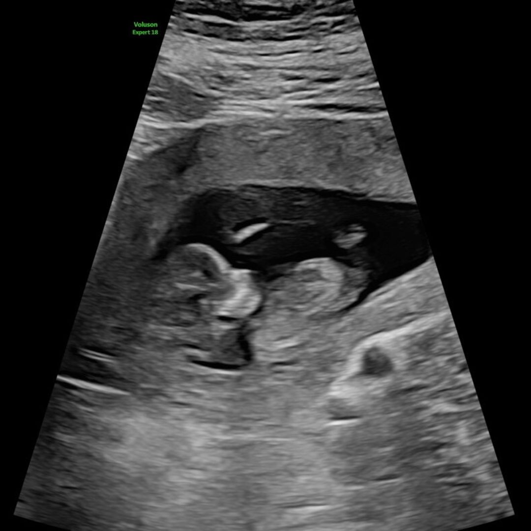 Photo shared by Amanda for their Babylist baby registry.