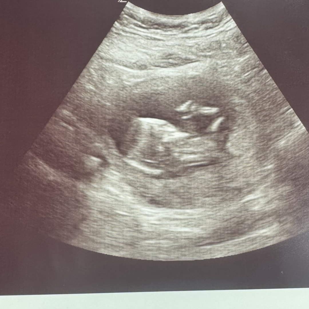Photo shared by Angela for their Babylist baby registry.
