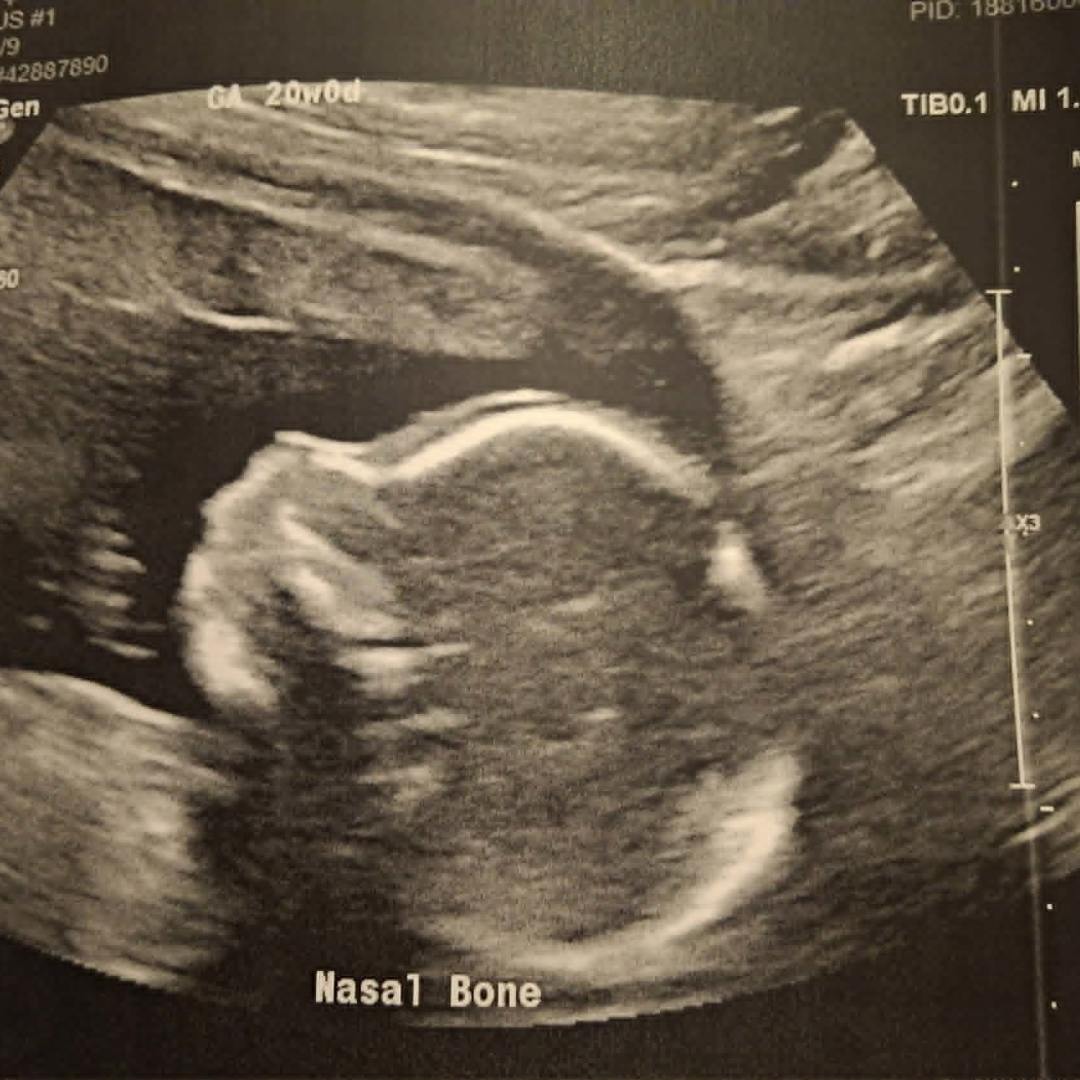 Photo shared by Danae for their Babylist baby registry.