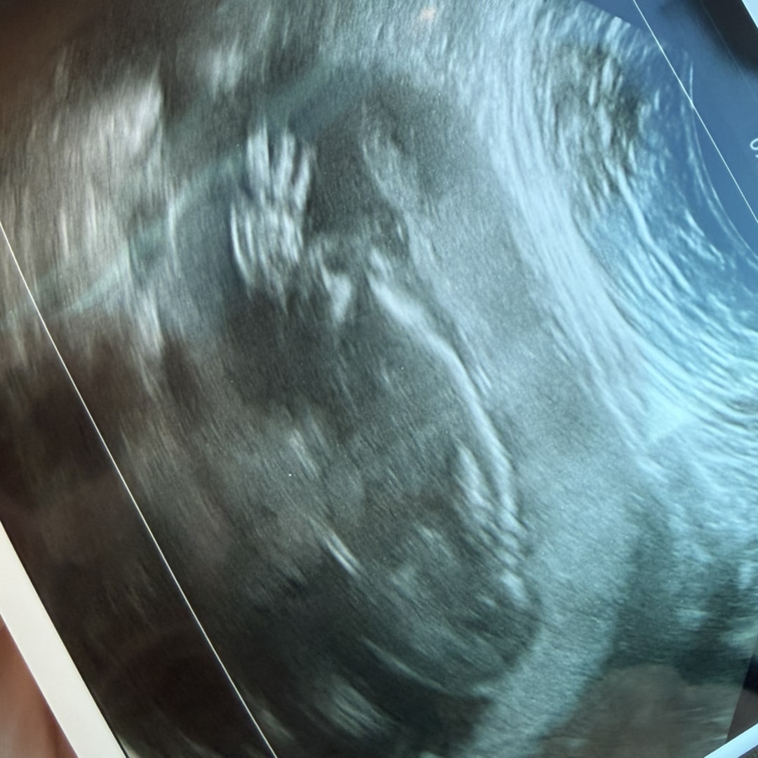 Photo shared by Teagan for their Babylist baby registry.