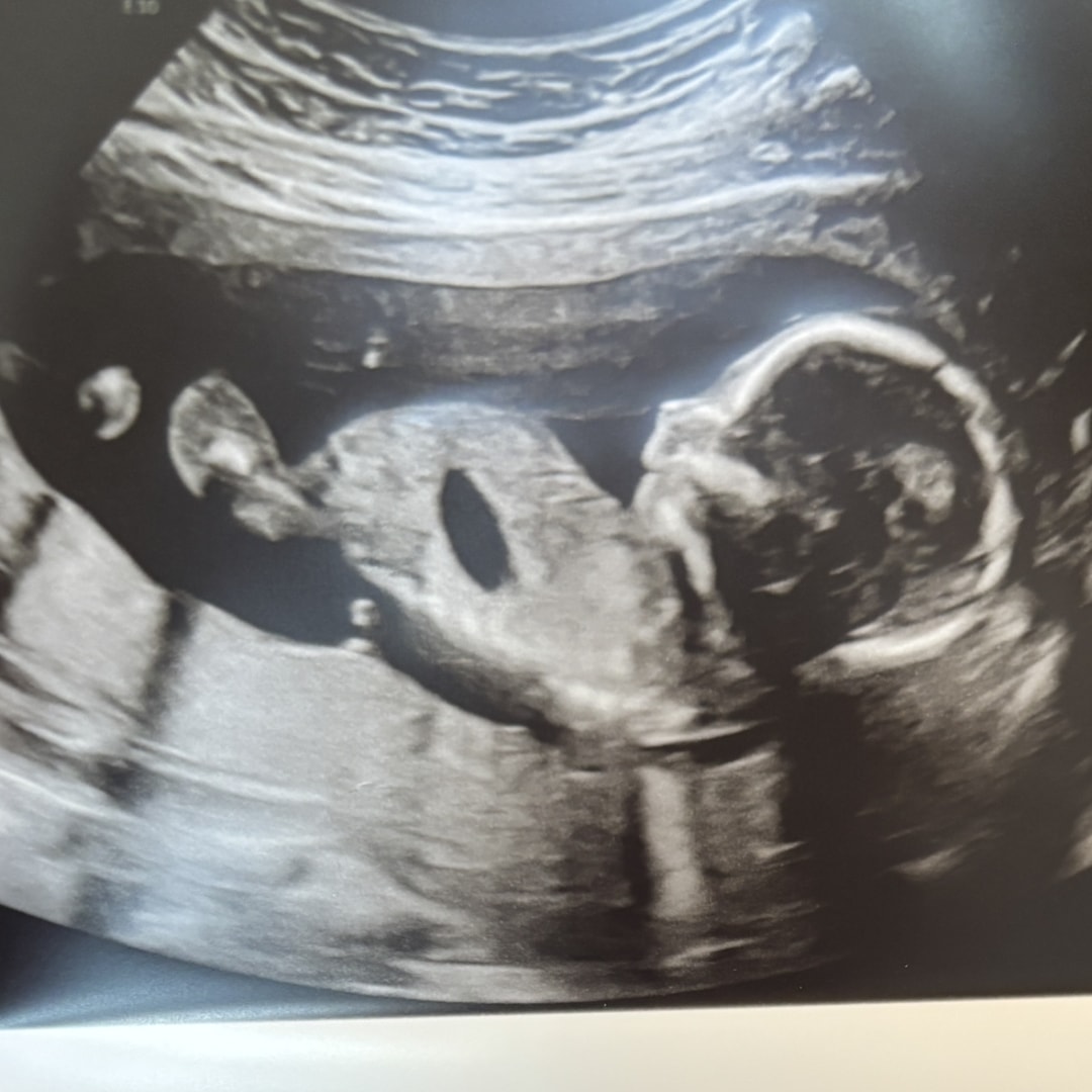 Photo shared by Halie for their Babylist baby registry.