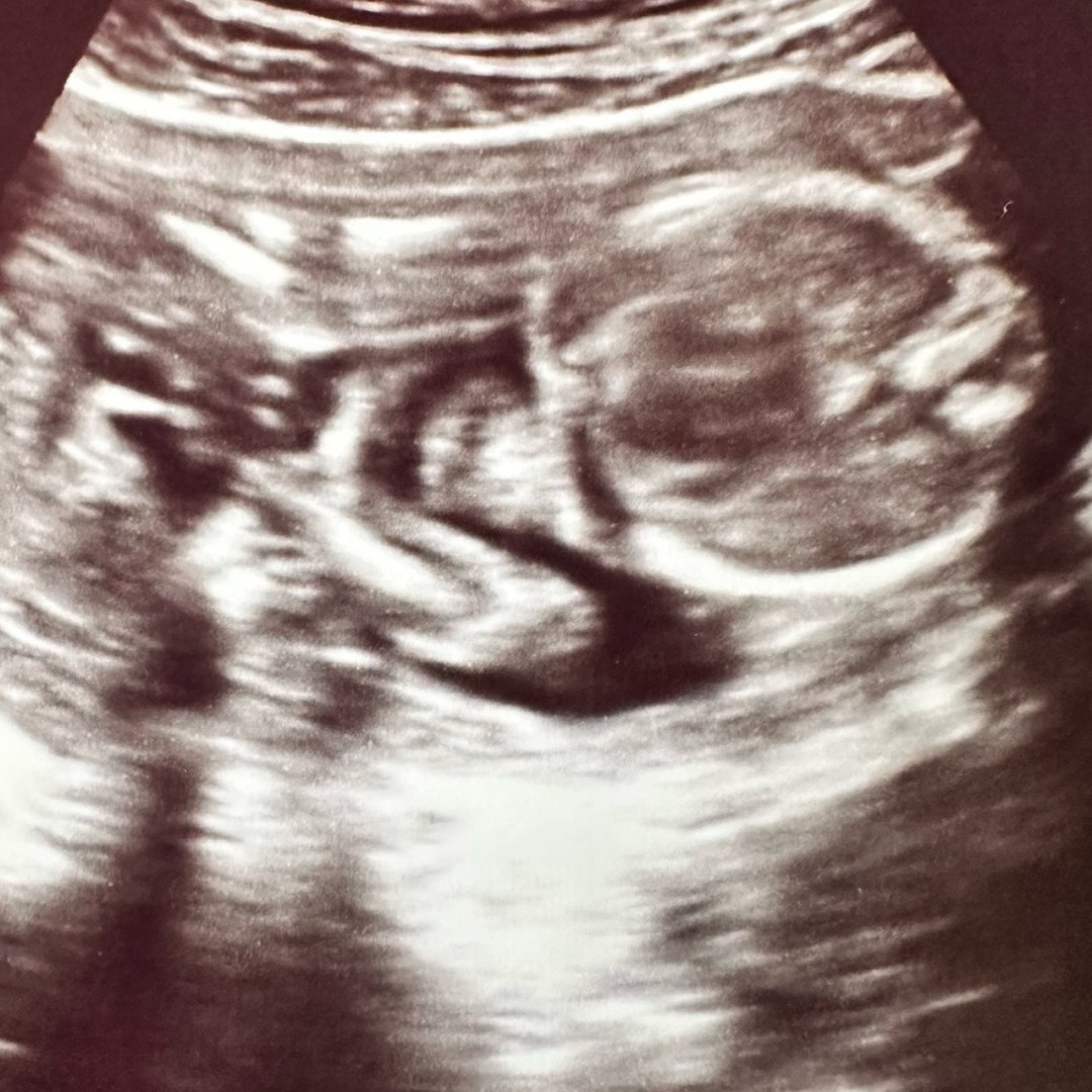 Photo shared by Daisy for their Babylist baby registry.