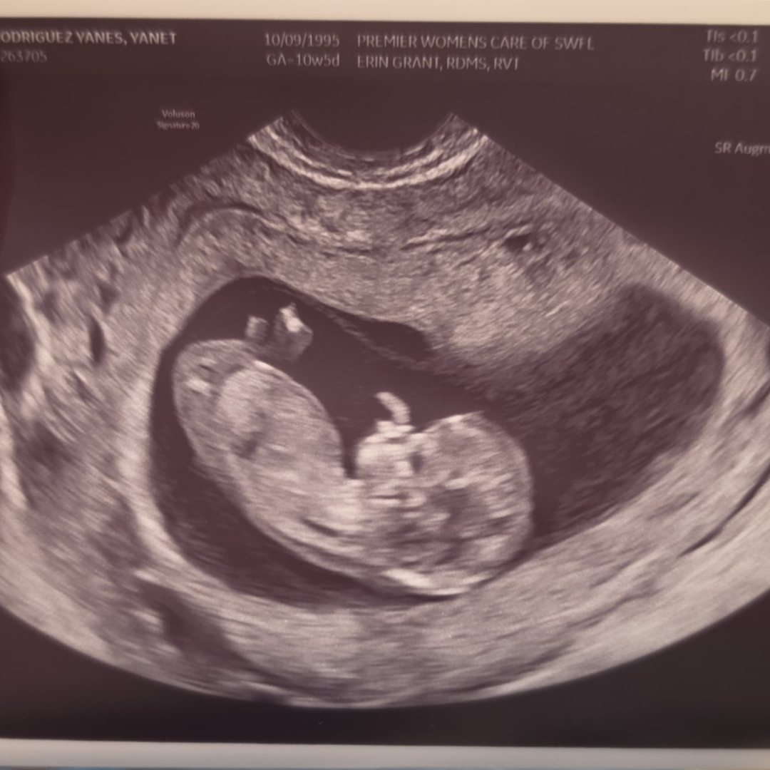 Photo shared by Yanet for their Babylist baby registry.