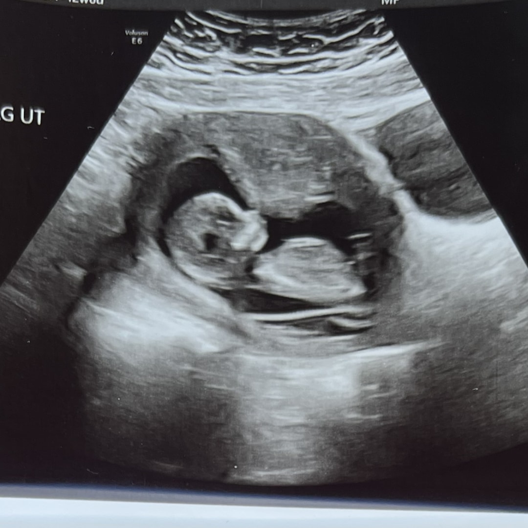 Photo shared by Breanna for their Babylist baby registry.