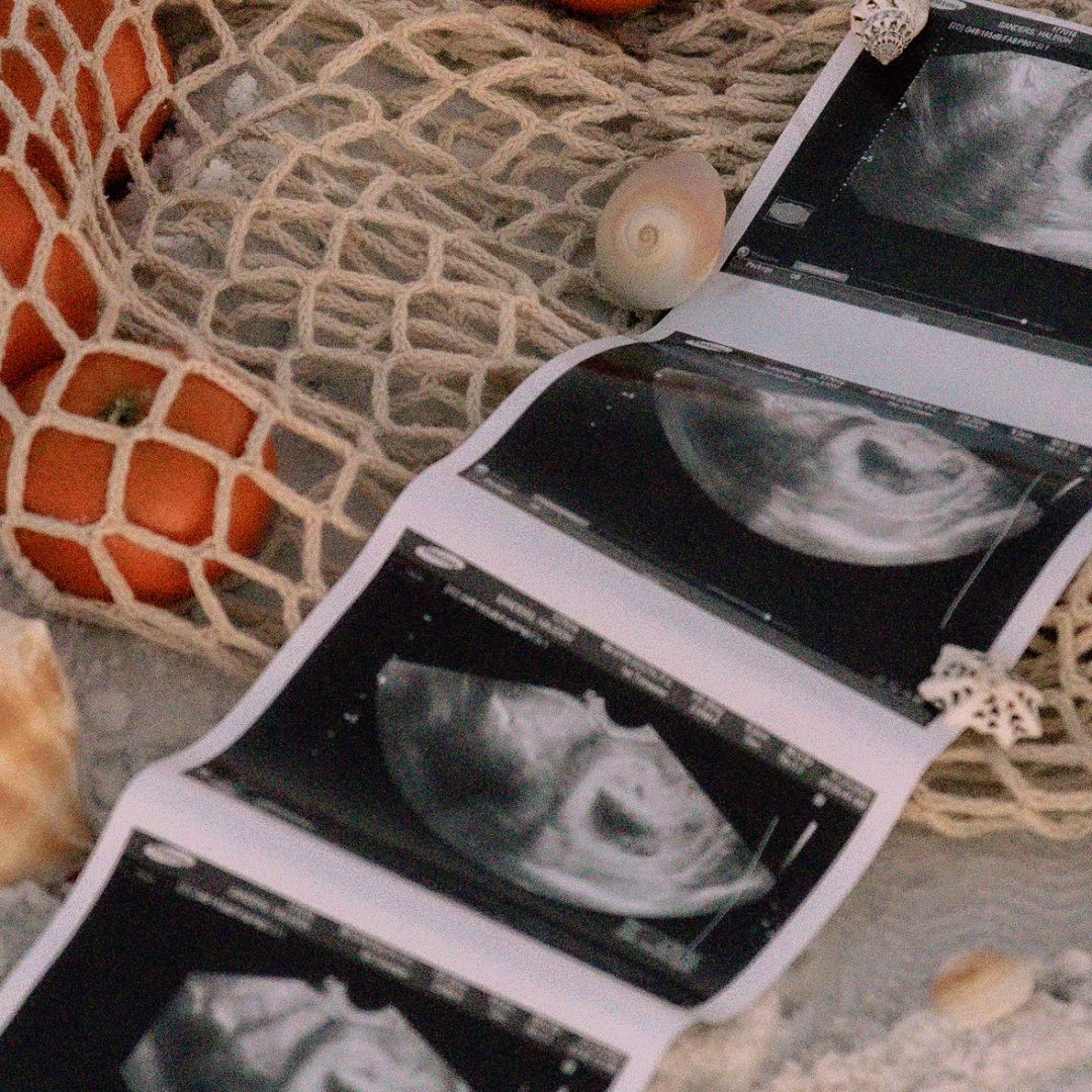 Photo shared by Haleigh for their Babylist baby registry.