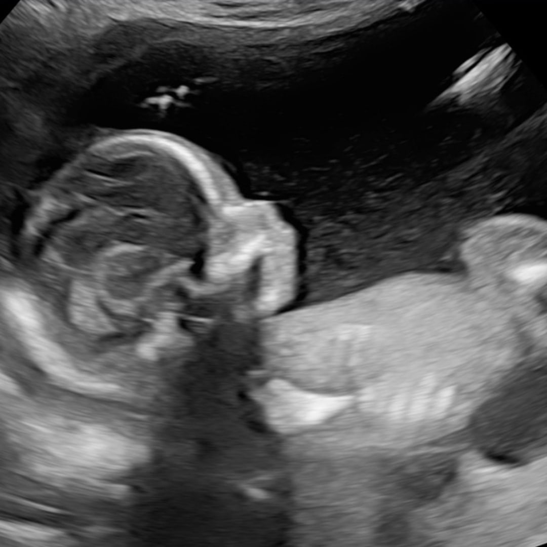 Photo shared by Evelynne for their Babylist baby registry.