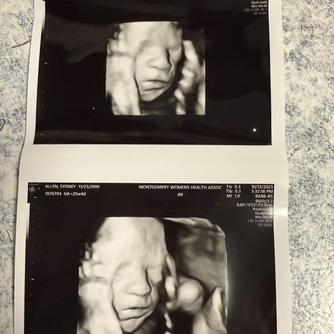 Photo shared by Shyanne for their Babylist baby registry.