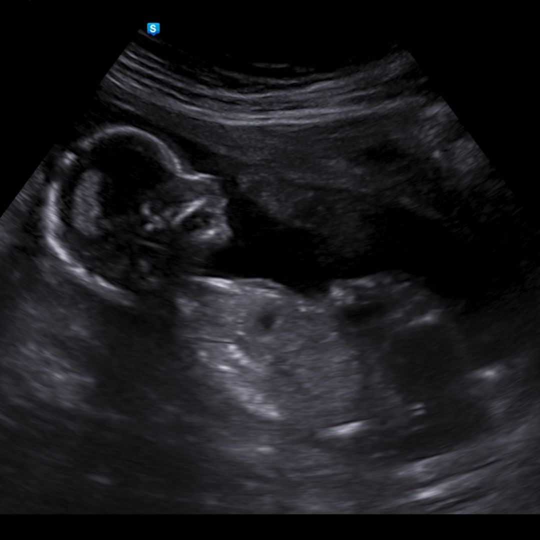 Photo shared by Sarah and Alejandro for their Babylist baby registry.