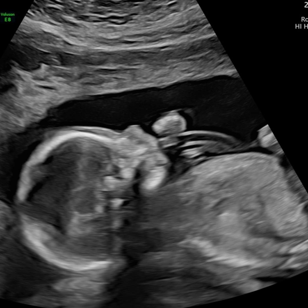 Photo shared by Rylee for their Babylist baby registry.