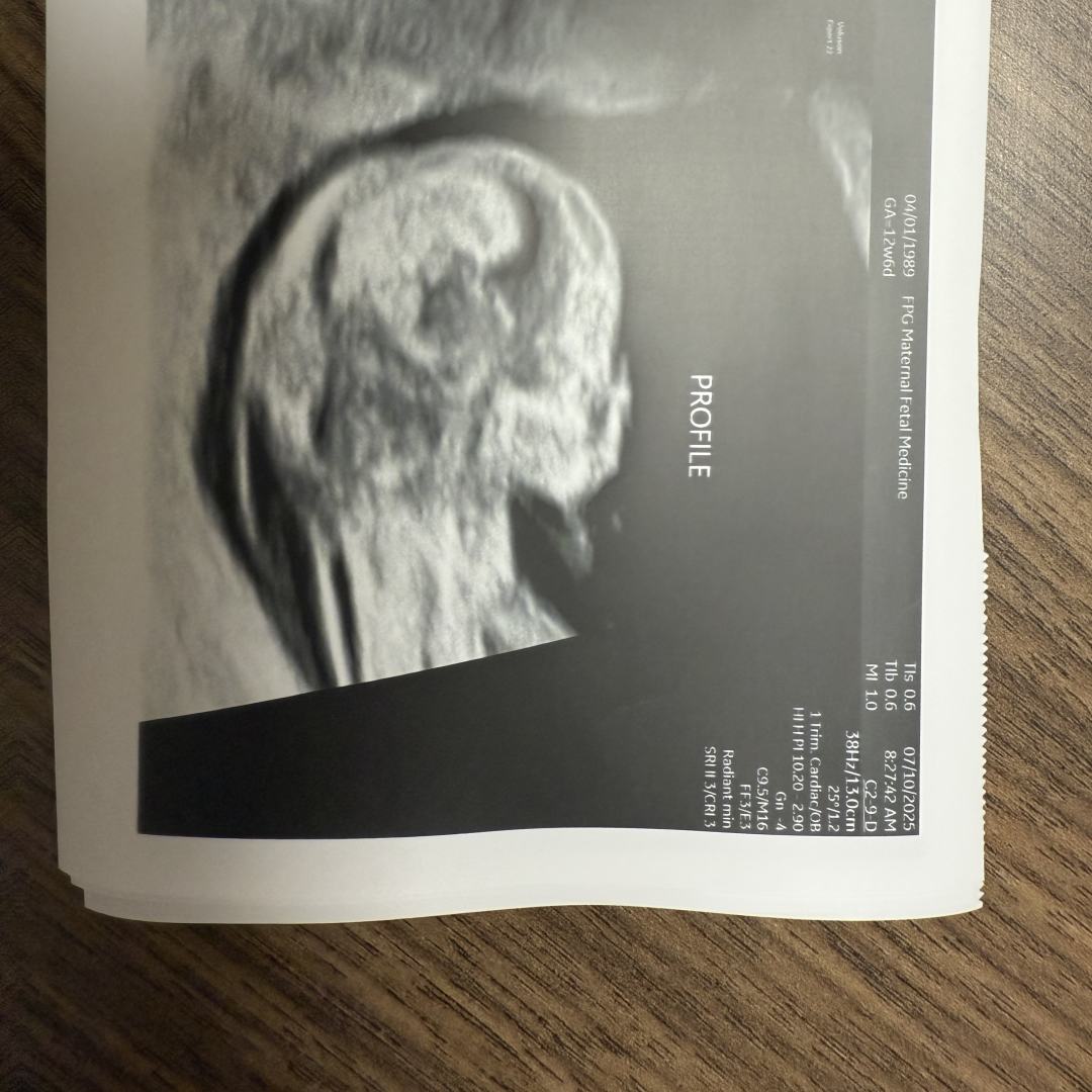 Photo shared by S for their Babylist baby registry.