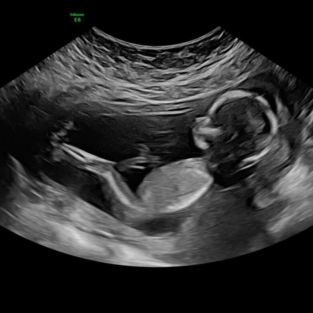 Photo shared by WinterRose for their Babylist baby registry.