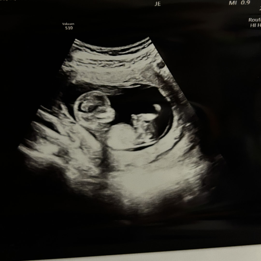 Photo shared by Alyssa for their Babylist baby registry.